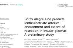 A-Linha-de-Porto-Alegre-Um-Novo-Conceito-Cirurgico-para-Gliomas-do-Lobo-da-Insula