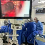 Imagem do fellow neurocirurgião Dr Victor Guimarães abrindo o meato acústico interno para remoção de schwanoma vestibular no Hospital Câncer Center – Guarapuava.